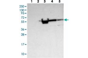 Western blot analysis of Lane 1: RT-4, Lane 2: U-251 MG, Lane 3: Human Plasma, Lane 4: Liver, Lane 5: Tonsil with ALKBH8 polyclonal antibody  at 1:250-1:500 dilution.