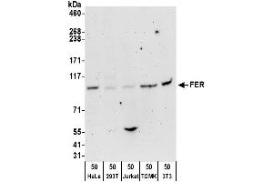 Western Blotting (WB) image for anti-FER Tyrosine Kinase (FER) (AA 400-450) antibody (ABIN7450246)