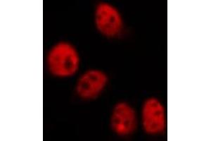 ABIN6269161 staining HeLa by IF/ICC. (CREB1 Antikörper  (Internal Region))