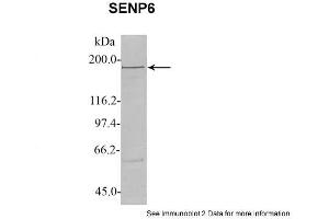 Sample Type: 1. (SENP6 Antikörper  (C-Term))
