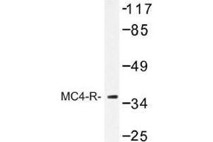 Image no. 1 for anti-Melanocortin 4 Receptor (MC4R) antibody (ABIN317754) (MC4R Antikörper)