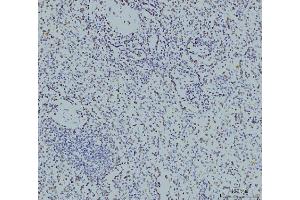 IHC analysis of RPA32/RPA2 using anti-RPA32/RPA2 antibody (ABIN7601379). (RPA2 Antikörper  (AA 34-254))