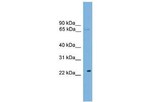 WB Suggested Anti-CALCOCO1 Antibody Titration: 0. (CALCOCO1 Antikörper  (N-Term))