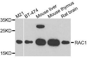 RAC1 Antikörper  (AA 1-192)