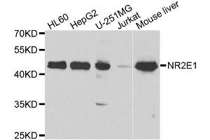 Western blot analysis of extracts of various cell lines, using NR2E1 antibody. (NR2E1 Antikörper  (AA 106-385))
