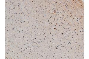 Immunohistochemistry (IHC) image for anti-LIM Domain Kinase 1 (LIMK1) (pThr508) antibody (ABIN6255701)