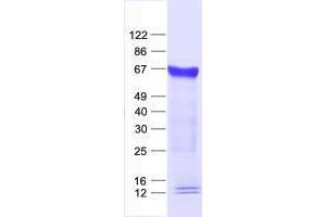 ZNF230 Protein (His tag)