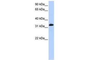 Image no. 1 for anti-Cardiac Troponin T (cTnT) (AA 72-121) antibody (ABIN6743074) (Cardiac Troponin T2 Antikörper  (AA 72-121))