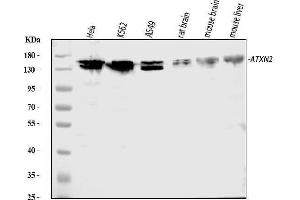 Western blot analysis of ATX2/ATXN2 using anti-ATX2/ATXN2 antibody (ABIN3043507). (Ataxin 2 Antikörper  (C-Term))