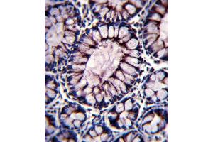 PIGR Antibody immunohistochemistry analysis in formalin fixed and paraffin embedded human colon tissue followed by peroxidase conjugation of the secondary antibody and DAB staining. (Stathmin 1 Antikörper  (C-Term))