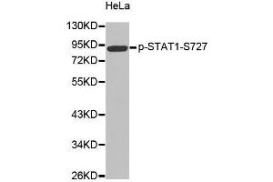 Western blot analysis of extracts from Hela cells, using Phospho-STAT1-S727 antibody.
