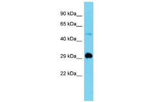 Host:  Rabbit  Target Name:  Mxi1  Sample Type:  Mouse Muscle lysates  Antibody Dilution:  1.