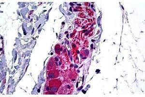 Human Intestine, Ganglion Cells: Formalin-Fixed, Paraffin-Embedded (FFPE) (HDAC6 Antikörper  (AA 7-56))