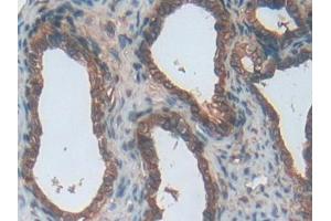 Used in DAB staining on fromalin fixed paraffin- embedded stomach tissue (ENPP1 Antikörper  (AA 568-793))