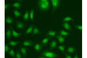Immunofluorescence analysis of A549 cell using CETN2 antibody. (CETN2 Antikörper)