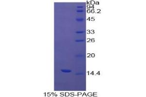 SDS-PAGE analysis of Cow Transthyretin Protein.