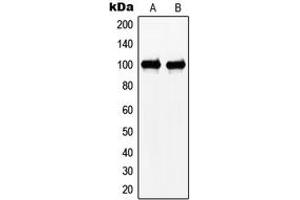 Western blot analysis of N4BP1 expression in HeLa (A), Jurkat (B) whole cell lysates. (N4BP1 Antikörper  (Center))