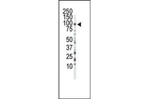 Western blot analysis of anti-FGFR3 Pab in Jurkat cell lysate. (FGFR3 Antikörper  (C-Term))