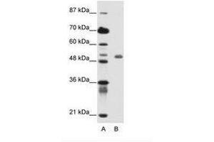 Image no. 1 for anti-Deformed Epidermal Autoregulatory Factor 1 (Drosophila) (DEAF1) (C-Term) antibody (ABIN6736145)