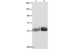Western blot analysis of Human liver cancer and stomach cancer tissue , using MUTYH Polyclonal Antibody at dilution of 1:1000 (MUTYH Antikörper)