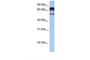 Image no. 1 for anti-Zinc Finger Protein 780B (ZNF780B) (AA 74-123) antibody (ABIN6739279) (ZNF780B Antikörper  (AA 74-123))