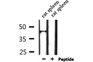 Western blot analysis of extracts from rat spleen, using IL18BP Antibody.