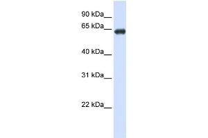 WB Suggested Anti-SLC39A4 Antibody Titration:  0. (SLC39A4 Antikörper  (N-Term))