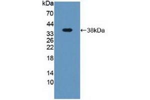 Detection of Recombinant DEFa2, Human using Polyclonal Antibody to Defensin Alpha 2 (DEFa2) (DEFA2 Antikörper  (AA 18-94))