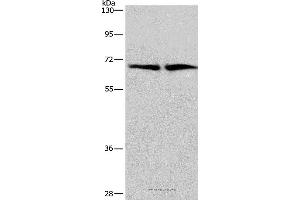 Western blot analysis of Human brain malignant glioma and bladder carcinoma tissue, using CDK5RAP3 Polyclonal Antibody at dilution of 1:449 (CDK5RAP3 Antikörper)