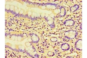 Immunohistochemistry of paraffin-embedded human small intestine tissue using ABIN7157760 at dilution of 1:100 (CCBL1 Antikörper  (AA 1-372))