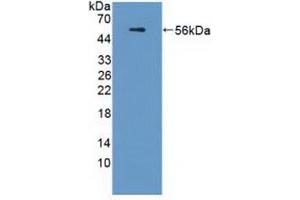 Detection of Recombinant APOL1, Human using Polyclonal Antibody to Apolipoprotein L (APOL1) (APOL1 Antikörper  (AA 1-238))