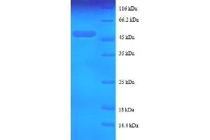 Tumor Necrosis Factor, alpha-Induced Protein 8 (TNFAIP8) (AA 2-198), (full length) protein (GST tag)