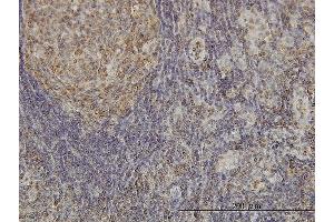 Immunoperoxidase of monoclonal antibody to CDKL4 on formalin-fixed paraffin-embedded human lymph node. (CDKL4 Antikörper  (AA 196-295))