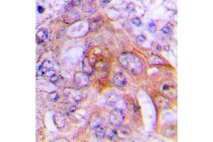 Immunohistochemical analysis of HADH2 staining in human lung formalin fixed paraffin embedded tissue section.