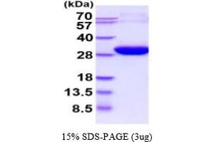 SDS-PAGE (SDS) image for Enoyl CoA Hydratase, Short Chain, 1, Mitochondrial (ECHS1) (AA 28-290) (Active) protein (His tag) (ABIN6388011)