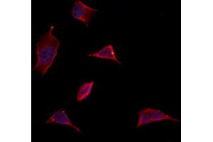 ABIN6263173 and ABIN6273135 staining Hela by IF/ICC. (MDH1 Antikörper  (C-Term))