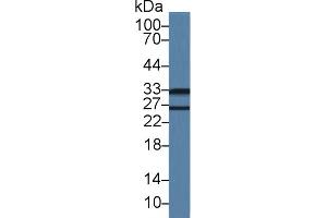 Western Blot; Sample: Mouse Lung lysate; Primary Ab: 1µg/ml Rabbit Anti-Mouse LDLRAP1 Antibody Second Ab: 0. (LDLRAP1 Antikörper  (AA 1-308))