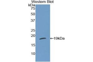 Western blot analysis of the recombinant protein. (Thrombospondin 1 Antikörper  (AA 511-670))
