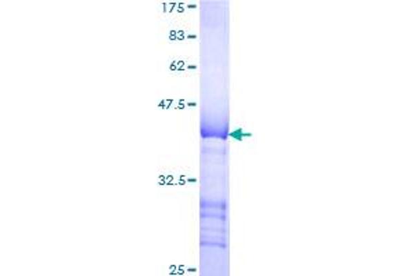 LTBP1 Protein (AA 403-500) (GST tag)