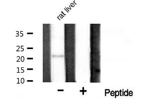Western blot analysis on rat liver tissue lysate using Bax Antibody (BAX Antikörper  (Internal Region))