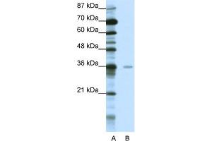 WB Suggested Anti-MBD2 Antibody Titration:  0. (MBD2 Antikörper  (Middle Region))