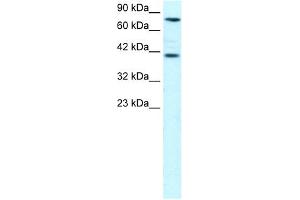 WB Suggested Anti-ZNF652 Antibody Titration: 0. (ZNF652 Antikörper  (N-Term))