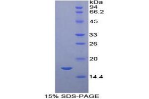 SDS-PAGE analysis of Human Complement 1 Inhibitor Protein. (SERPING1 Protein)
