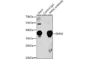 Immunoprecipitation analysis of 200 μg extracts of 293T cells, using 3 μg SMN2 antibody (ABIN6127949, ABIN6148136, ABIN6148139 and ABIN6218739). (SMN2 Antikörper  (AA 1-197))