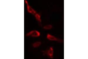 ABIN6275395 staining  HeLa cells by IF/ICC. (SLU7 Antikörper  (Internal Region))