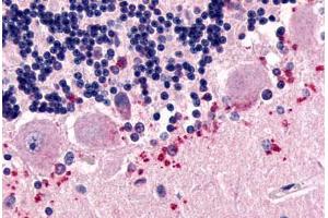 Immunohistochemistry (IHC) image for anti-Cadherin EGF LAG Seven Pass G-Type Receptor 3 (CELSR3) (N-Term) antibody (ABIN1048436)