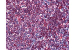 Anti-SC5DL antibody IHC of human tonsil. (SC5DL Antikörper  (AA 71-120))