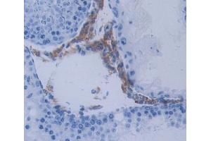 Used in DAB staining on fromalin fixed paraffin- embedded Kidney tissue (METTL21C Antikörper  (AA 1-248))