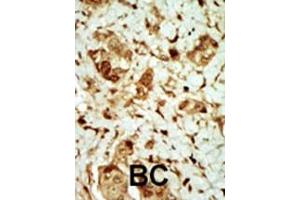 Immunohistochemistry (Paraffin-embedded Sections) (IHC (p)) image for anti-Protein Kinase, AMP-Activated, gamma 3 Non-Catalytic Subunit (PRKAG3) (AA 148-178) antibody (ABIN391060)