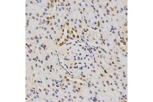 Immunohistochemistry of paraffin-embedded rat kidney tissue using H3K79me3 antibody at dilution of 1:200 (x400 lens).
